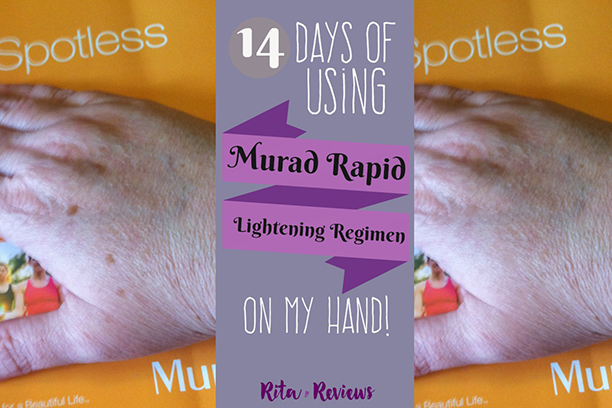 14 Days of Using Murad on my hand