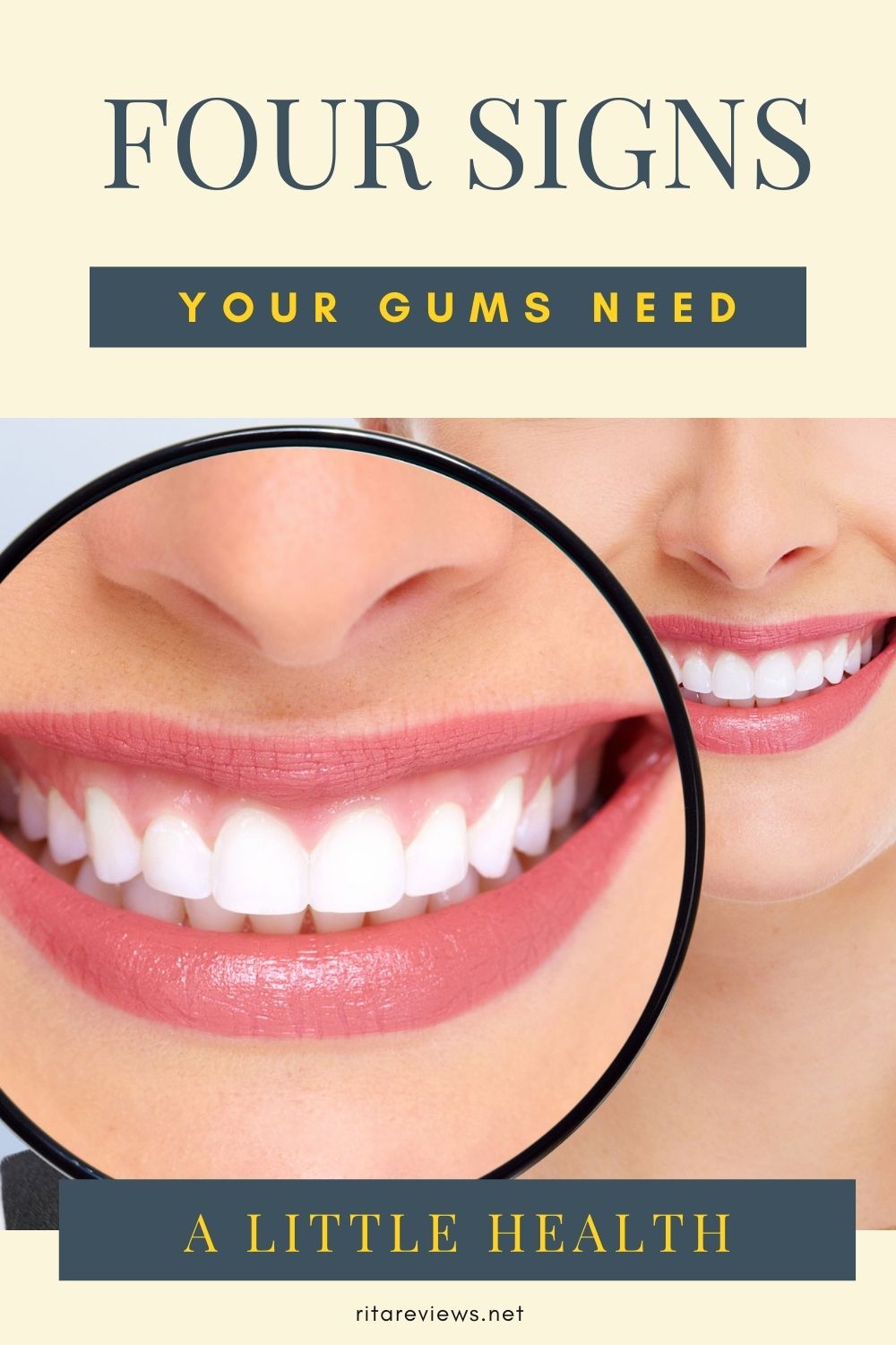 Four Signs Your Gums Need A Little Help