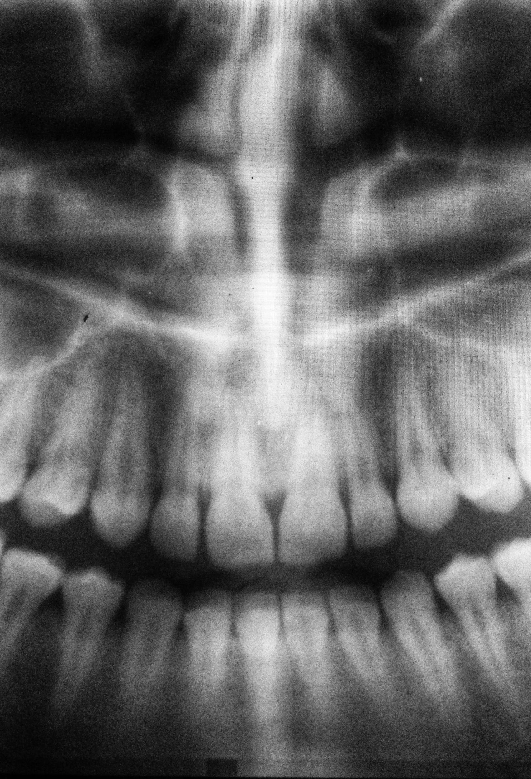 5 Considerations When Buying Dental X-Ray Machines - Rita Reviews