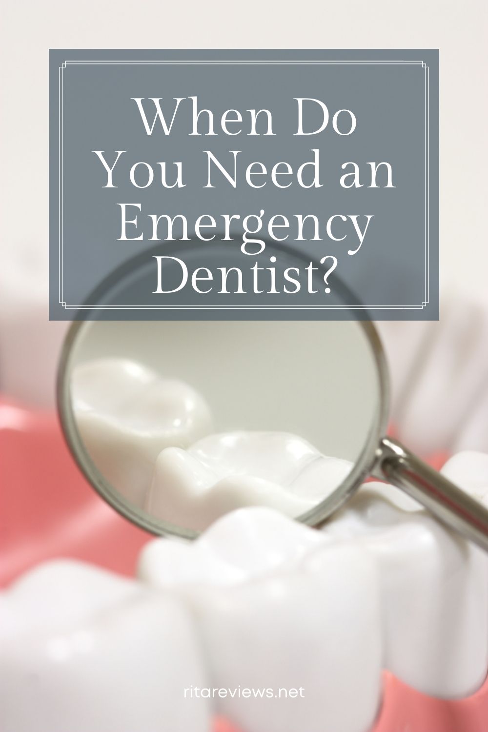 When Do You Need an Emergency Dentist