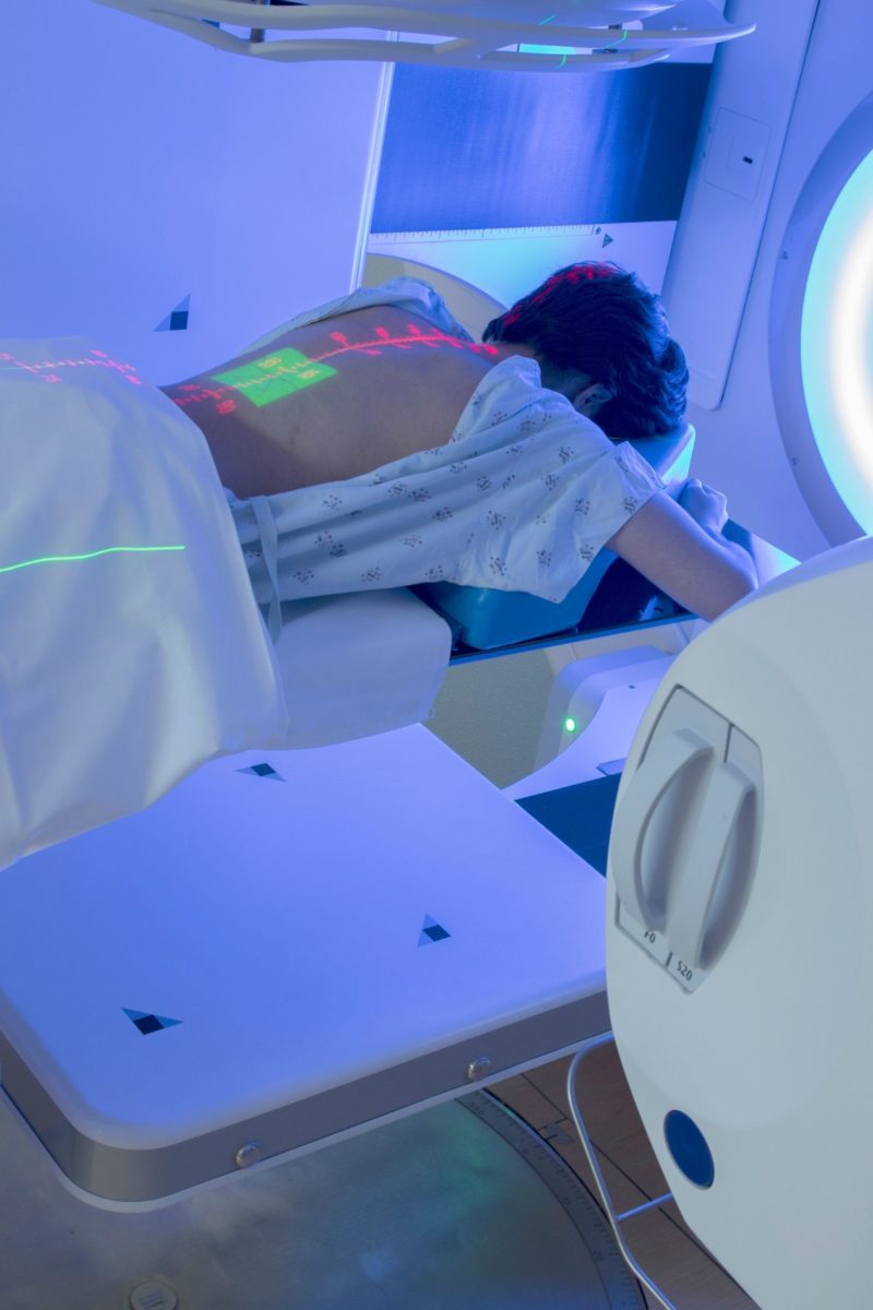 What You Didn't Know About Radiotherapy- Rita Reviews