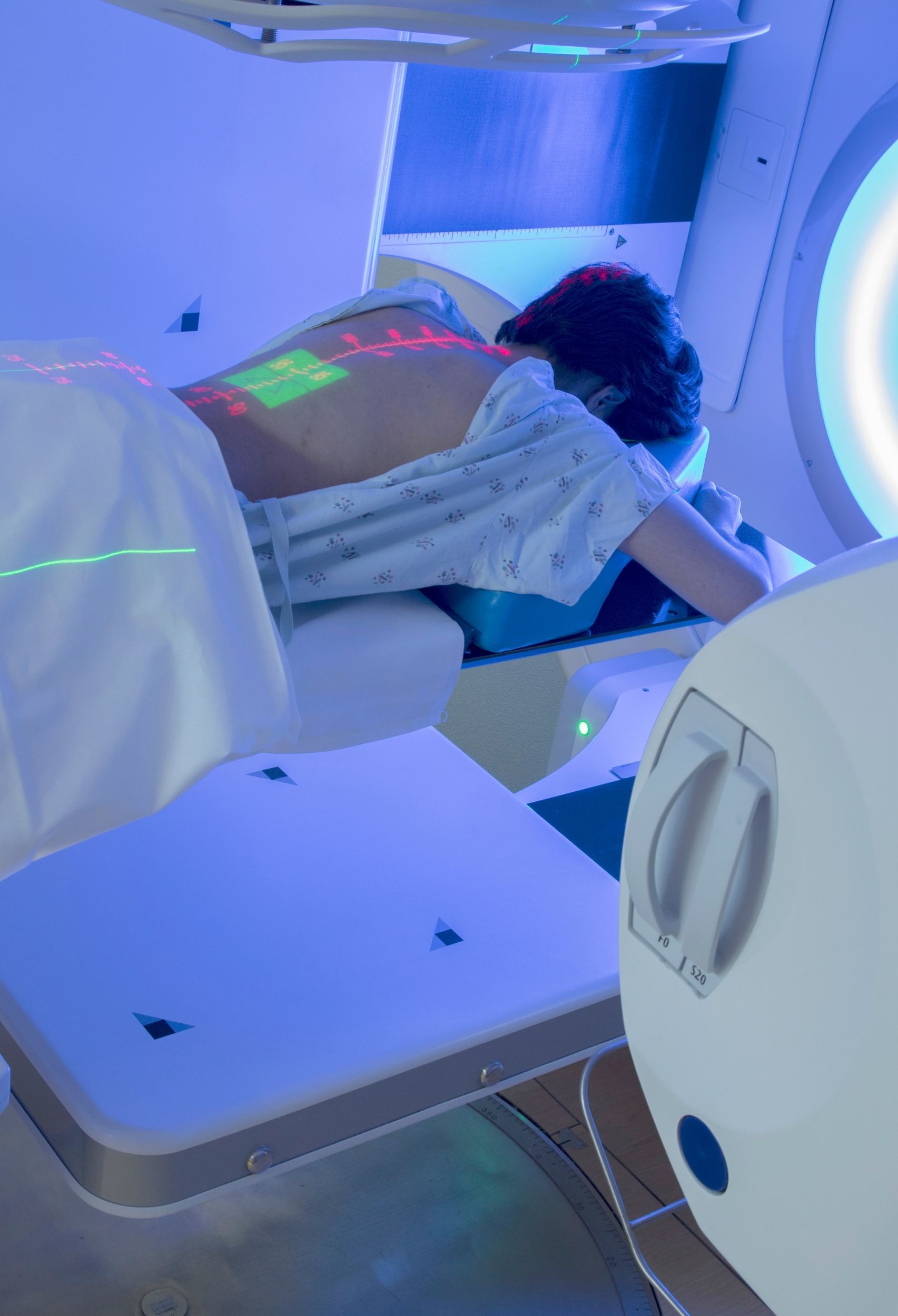 What You Didn't Know About Radiotherapy- Rita Reviews