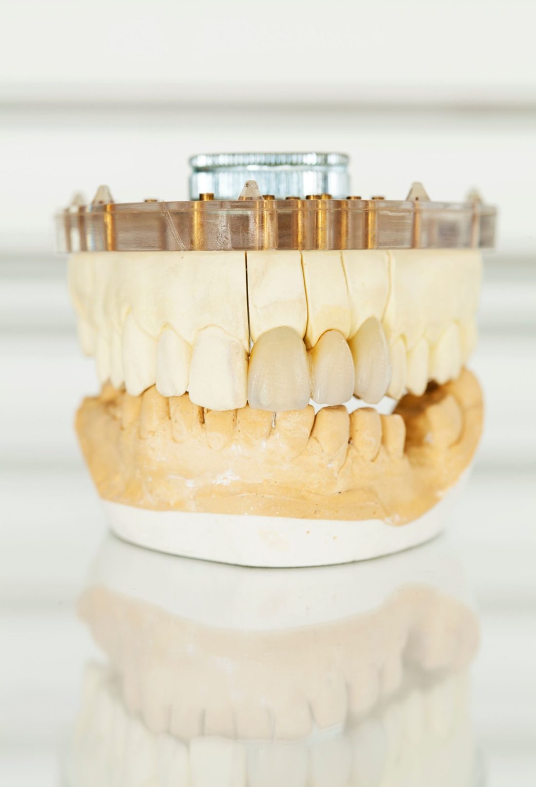 Learn More About Dental Crowns