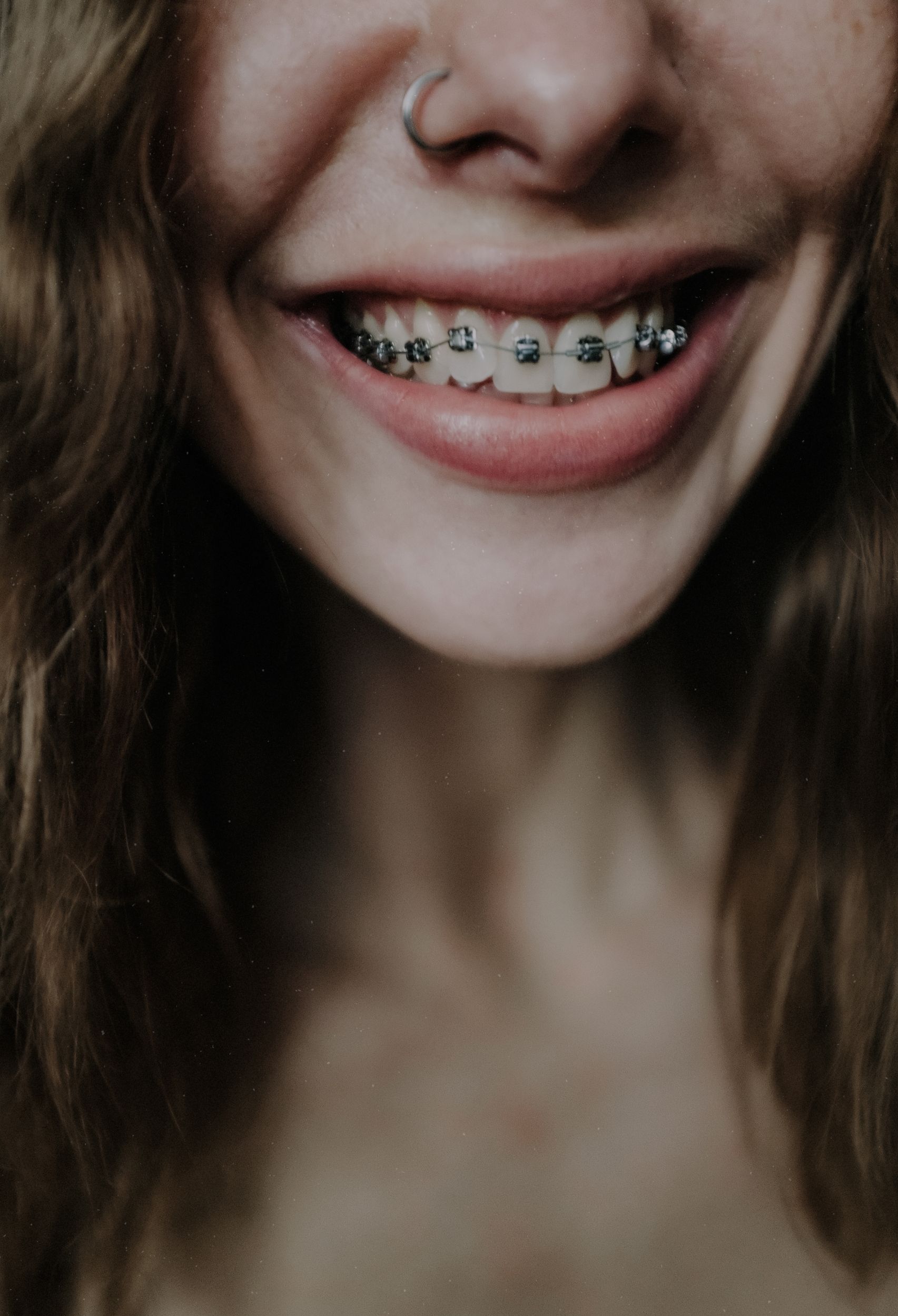 Top Tips For Wearing Braces