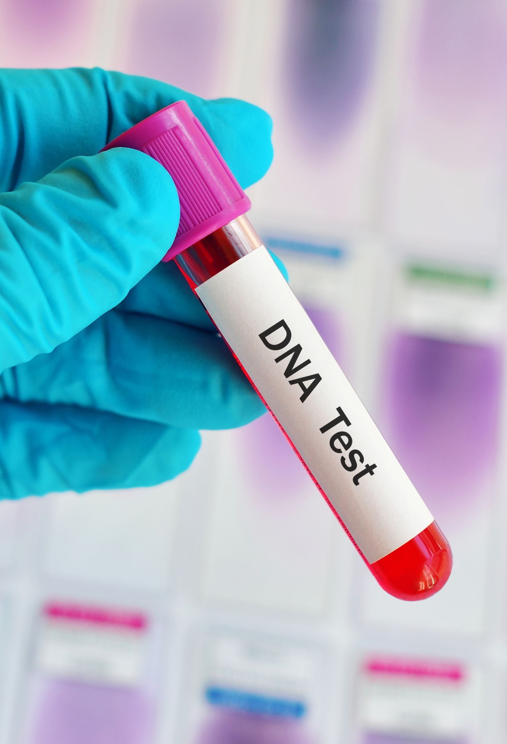 3 Things You Have To Know About DNA Testing