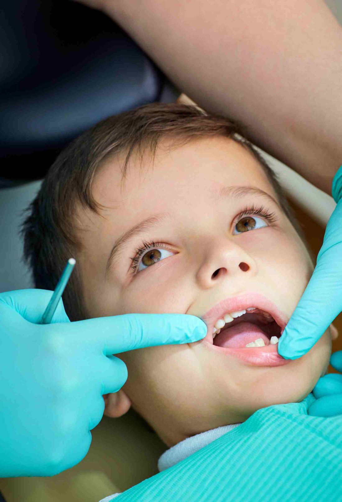 Protecting Your Family's Smile: Navigating Dental Care in Kennesaw, Georgia