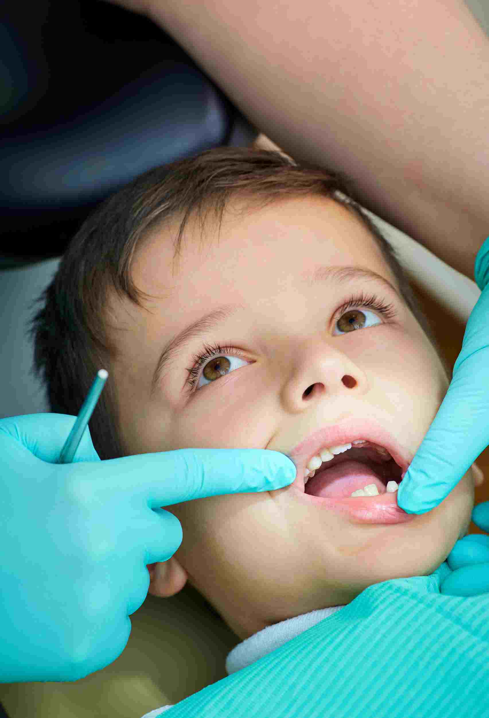 Protecting Little Smiles 7 Pediatric Dental Care Blunders Parents Should Avoid