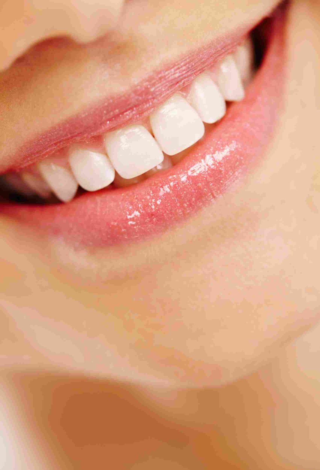 Smile Makeovers: Innovative Cosmetic Solutions for Teeth Gap Closure