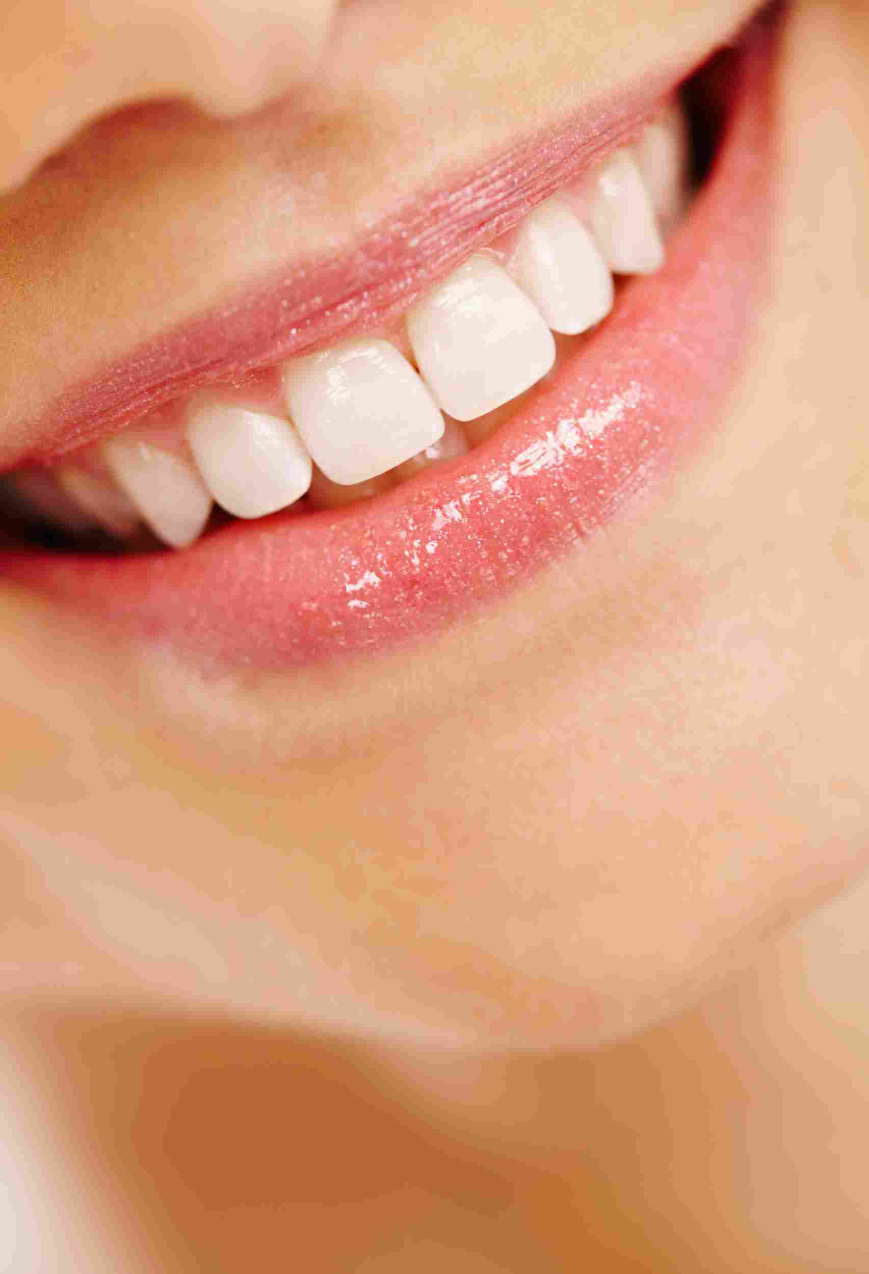 Smile Makeovers: Innovative Cosmetic Solutions for Teeth Gap Closure