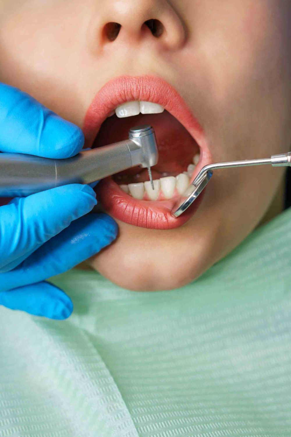Beyond the Drill Painless Dentistry Techniques for the Modern Age