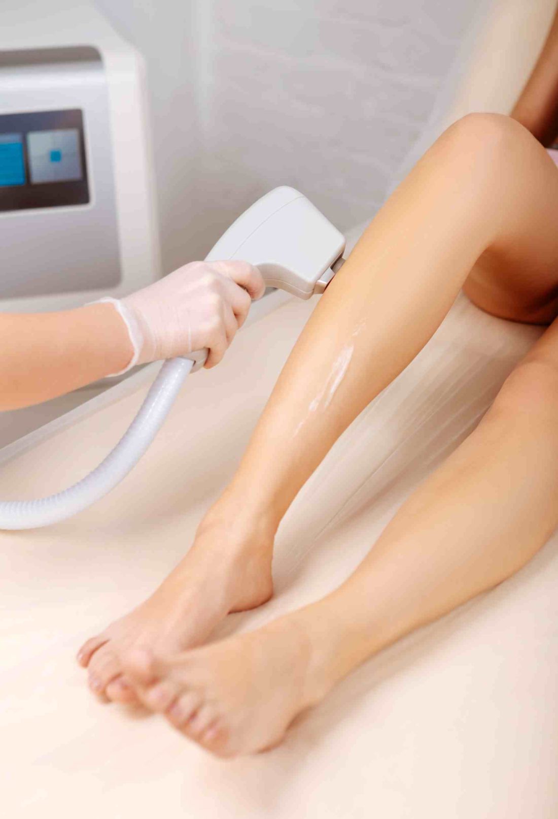 Preparation Guide: Important Facts About Laser Hair Removal