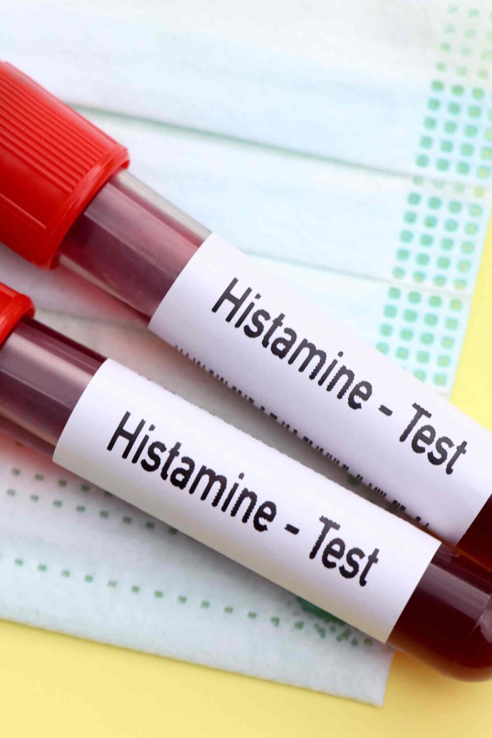 Don’t Let Histamine Affect Your Health: Reclaim Control with These Tips