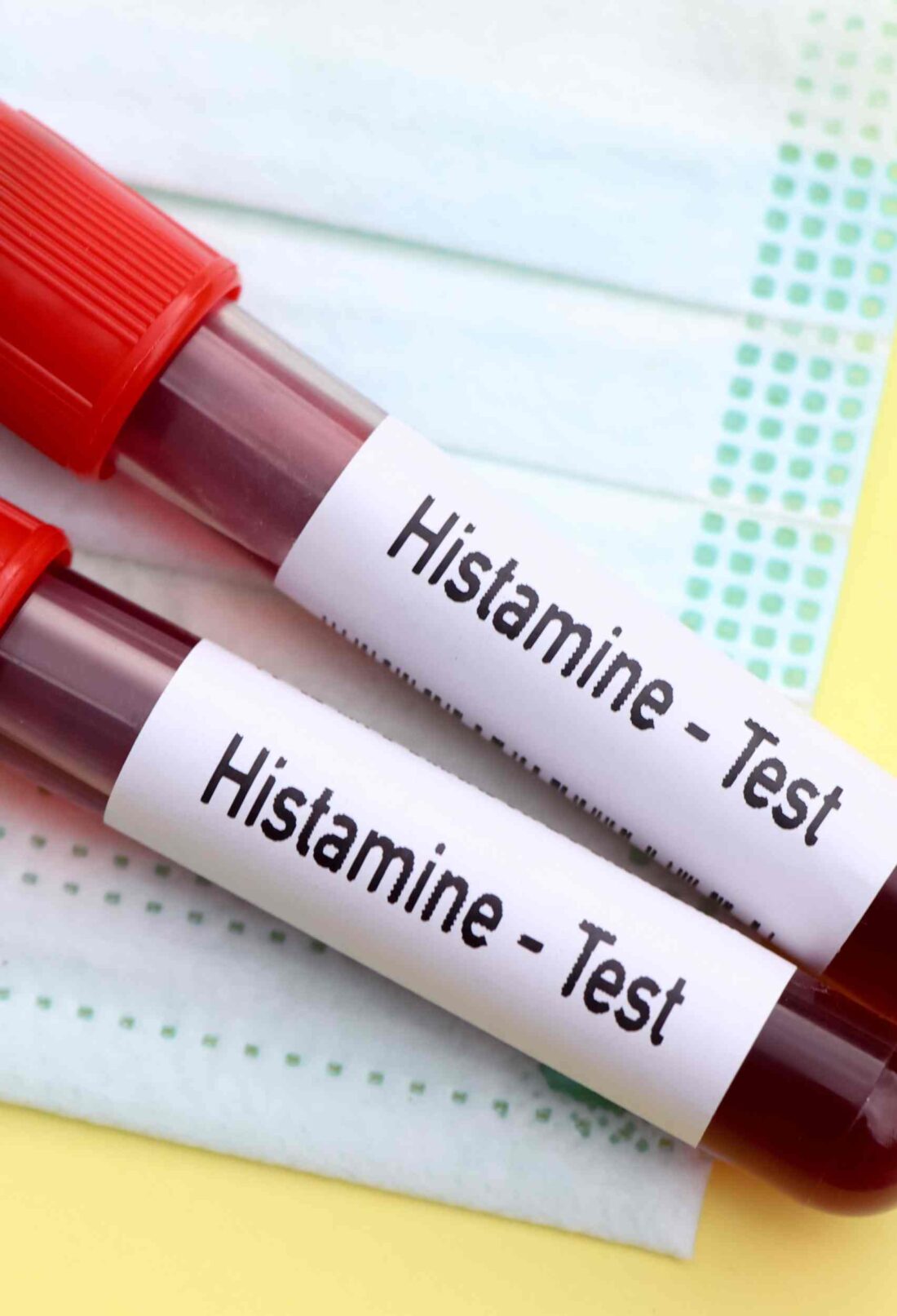 Don’t Let Histamine Affect Your Health: Reclaim Control with These Tips