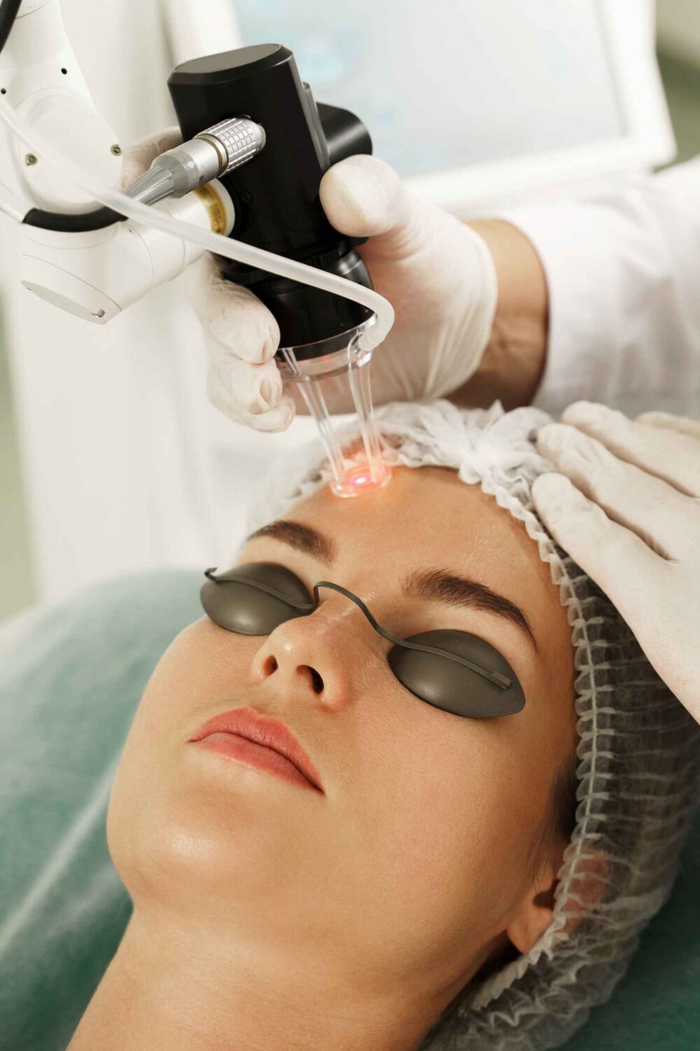 Considering PicoSure Laser Treatment in Singapore Here's what to Expect After Treatment