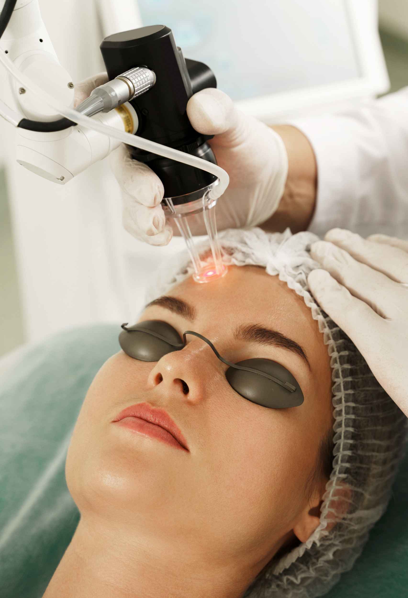 Considering PicoSure Laser Treatment in Singapore Here's what to Expect After Treatment