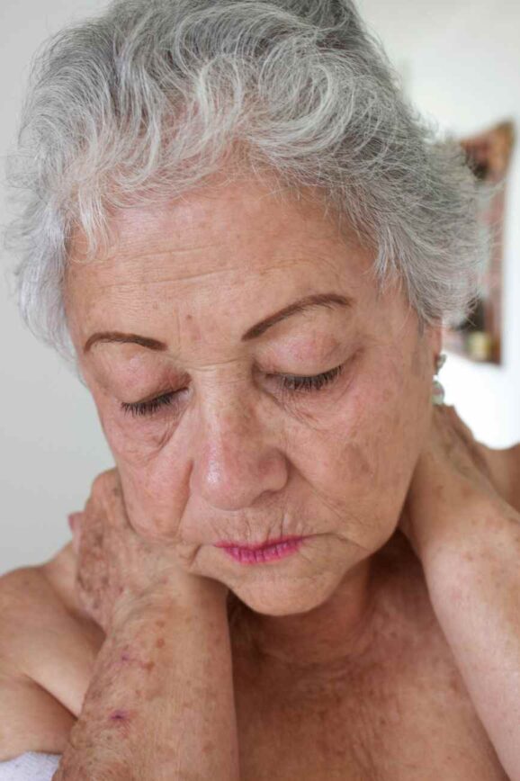 5 Tips to Manage Frown Lines