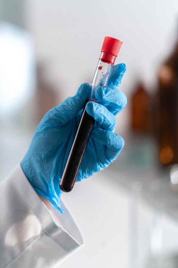 Understanding Clinical Trials: A Comprehensive Guide for Potential Participants