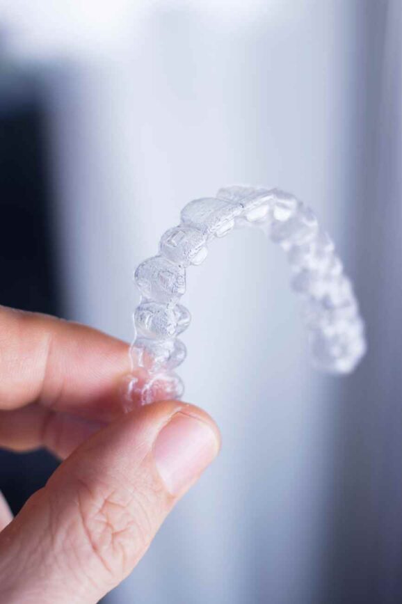 The Impact of Clear Aligners in Modern Orthodontics