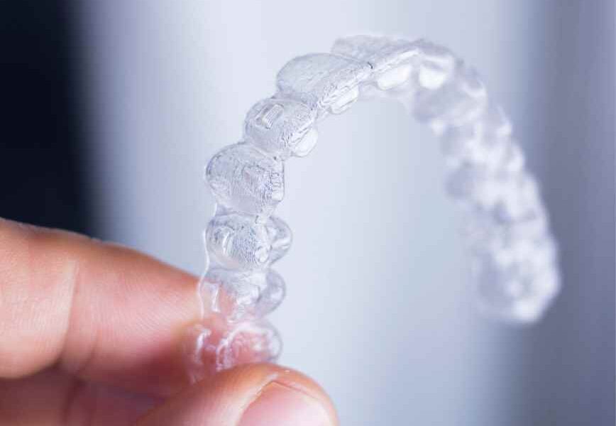 The Impact of Clear Aligners in Modern Orthodontics