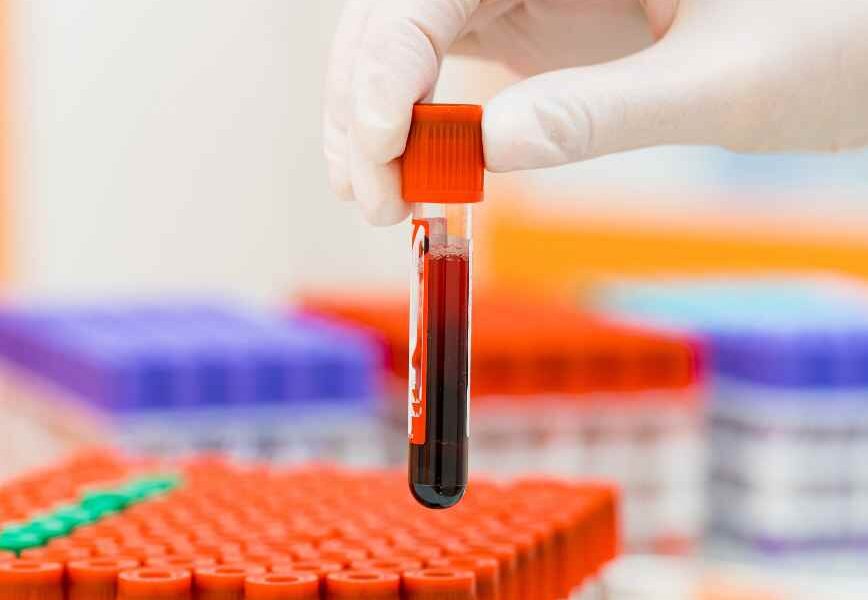The Critical Role of Clinical Trials in Advancing Modern Medicine