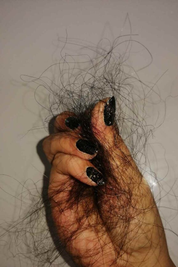 The Hidden Biology Of Thinning Hair