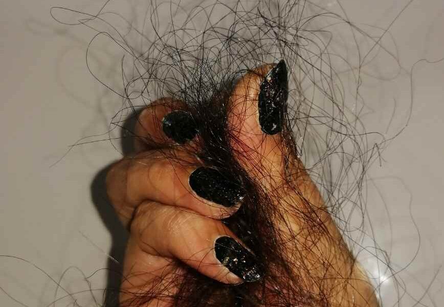 The Hidden Biology Of Thinning Hair