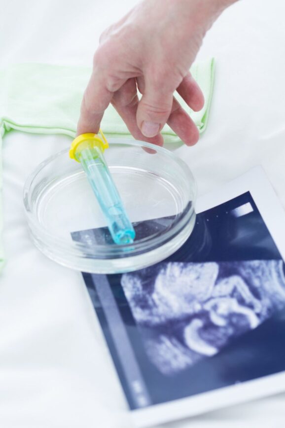 Fertility Care in Hong Kong_ How to Make Informed Choices