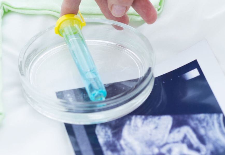 Fertility Care in Hong Kong_ How to Make Informed Choices