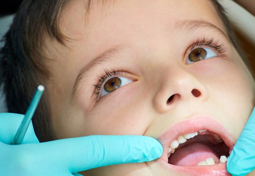 Need a Kids Dentist? How Stellar Kids Dentistry Helps Washington Families Build Healthy, Confident Smiles