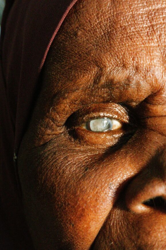 The Quiet Clouding Of Your Eyes And How To See Clearly Again