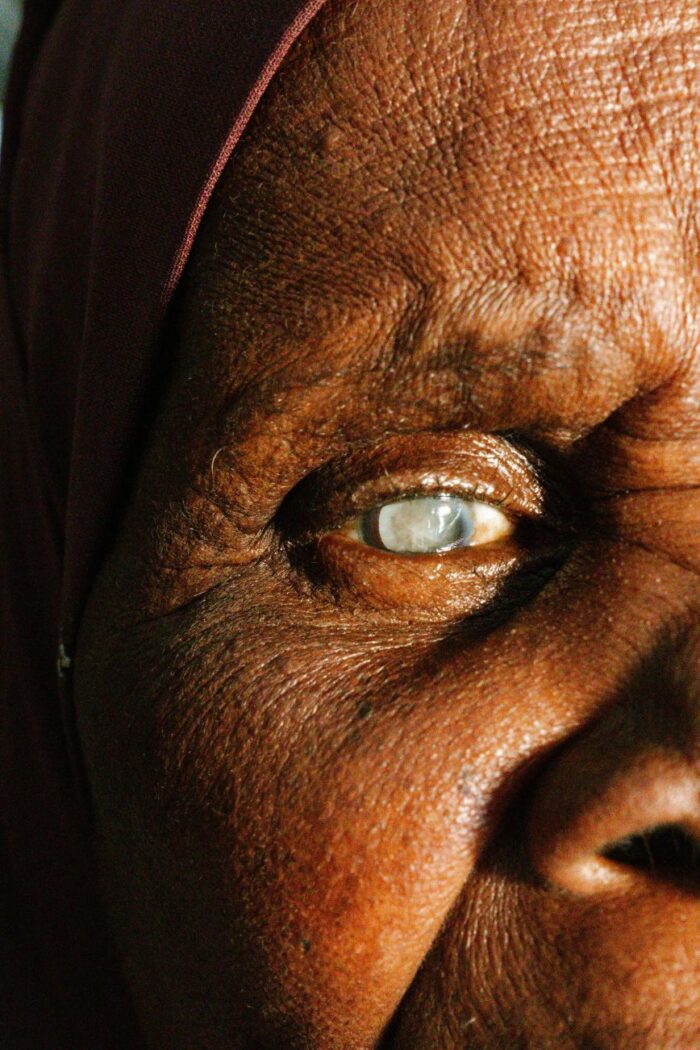 The Quiet Clouding Of Your Eyes And How To See Clearly Again