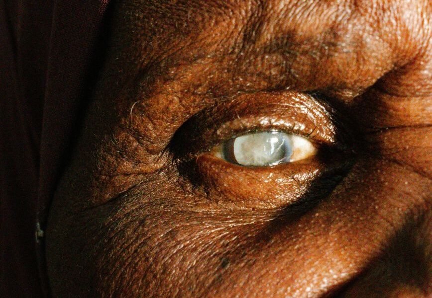 The Quiet Clouding Of Your Eyes And How To See Clearly Again