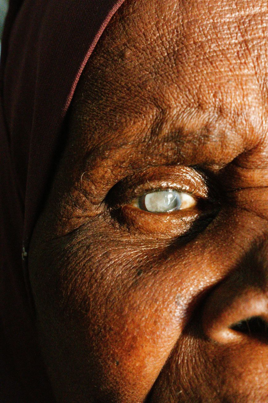 The Quiet Clouding Of Your Eyes And How To See Clearly Again