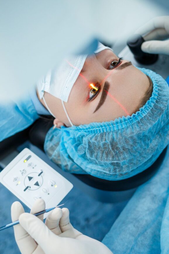 What To Know Before Choosing Laser Eye Surgery